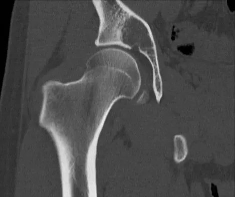 Basic Science 2008 Practice Questions: Set 3 (Solved) - Figure 32