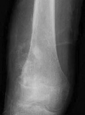 Basic Science 2008 Practice Questions: Set 3 (Solved) - Figure 36