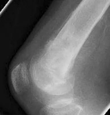 Basic Science 2008 Practice Questions: Set 3 (Solved) - Figure 37