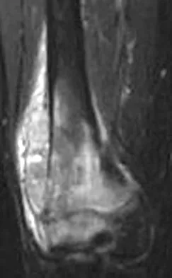 Basic Science 2008 Practice Questions: Set 3 (Solved) - Figure 38