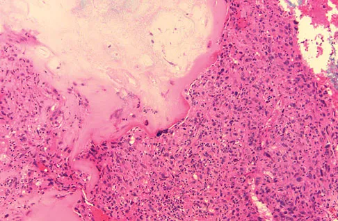 Basic Science 2008 Practice Questions: Set 3 (Solved) - Figure 46