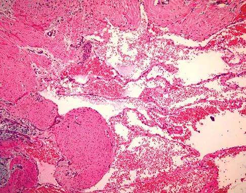 Basic Science 2008 Practice Questions: Set 3 (Solved) - Figure 5