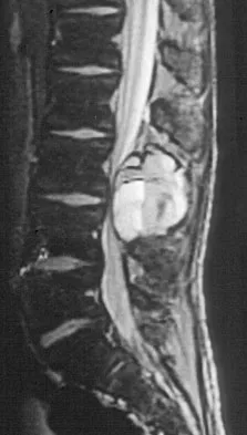 Basic Science 2008 Practice Questions: Set 3 (Solved) - Figure 54