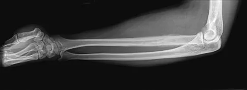 Basic Science 2008 Practice Questions: Set 3 (Solved) - Figure 58