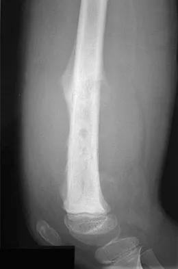 Basic Science 2008 Practice Questions: Set 3 (Solved) - Figure 64
