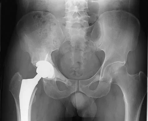 Basic Science 2008 Practice Questions: Set 3 (Solved) - Figure 74