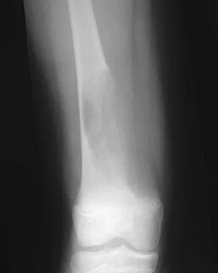Basic Science 2008 Practice Questions: Set 3 (Solved) - Figure 77