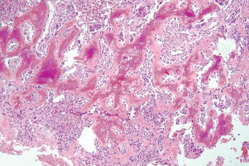 Basic Science Board Review 2008: High-Yield MCQs (Set 4) - Figure 13