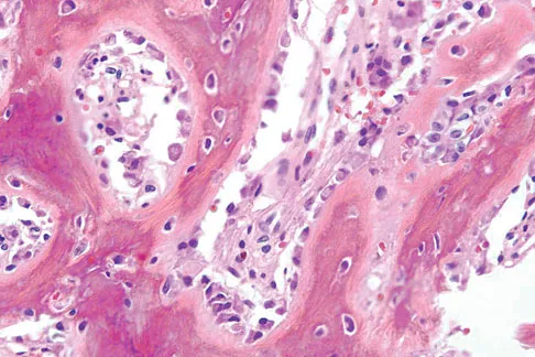 Basic Science Board Review 2008: High-Yield MCQs (Set 4) - Figure 14