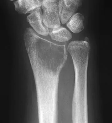 Basic Science Board Review 2008: High-Yield MCQs (Set 4) - Figure 16