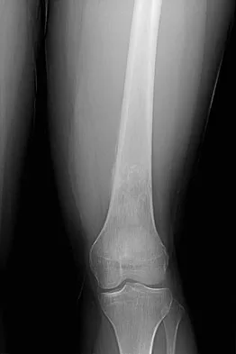 Basic Science Board Review 2008: High-Yield MCQs (Set 4) - Figure 20
