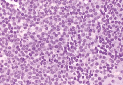Basic Science Board Review 2008: High-Yield MCQs (Set 4) - Figure 30