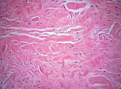 Basic Science Board Review 2008: High-Yield MCQs (Set 4) - Figure 33