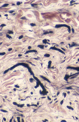Basic Science Board Review 2008: High-Yield MCQs (Set 4) - Figure 34