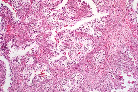 Basic Science Board Review 2008: High-Yield MCQs (Set 4) - Figure 36