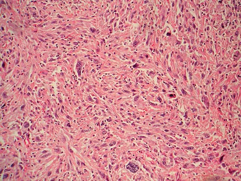 Basic Science Board Review 2008: High-Yield MCQs (Set 4) - Figure 43