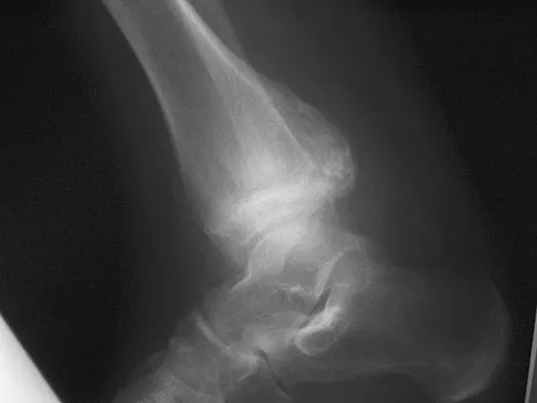 Basic Science Board Review 2008: High-Yield MCQs (Set 4) - Figure 46