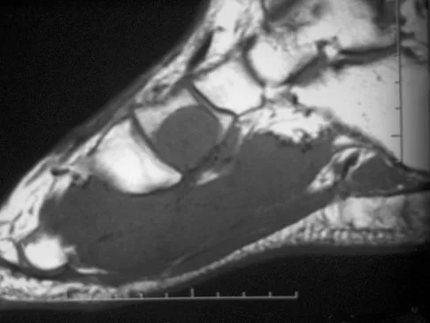 Basic Science Board Review 2008: High-Yield MCQs (Set 4) - Figure 49