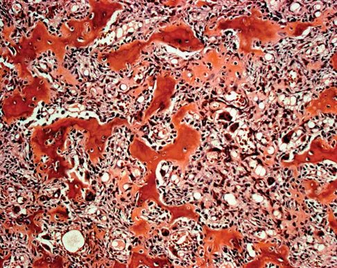 Basic Science Board Review 2008: High-Yield MCQs (Set 4) - Figure 5