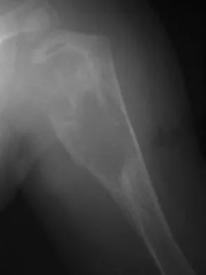 Basic Science Board Review 2008: High-Yield MCQs (Set 4) - Figure 52