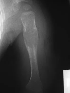 Basic Science Board Review 2008: High-Yield MCQs (Set 4) - Figure 53