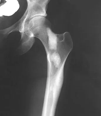 Basic Science Board Review 2008: High-Yield MCQs (Set 4) - Figure 8