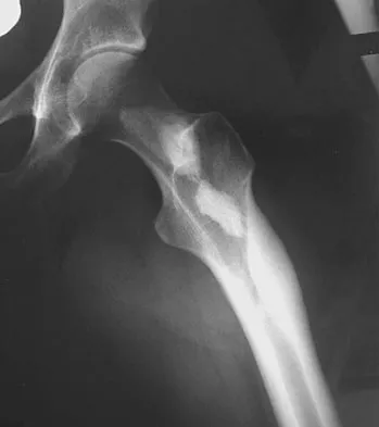 Basic Science Board Review 2008: High-Yield MCQs (Set 4) - Figure 9