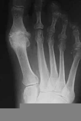 Foot & Ankle 2000 Practice Questions: Set 1 (Solved) Figure 1