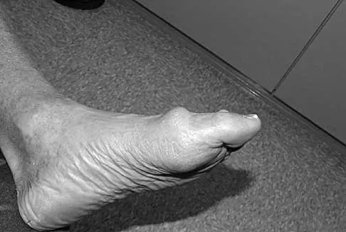 Foot & Ankle 2000 Practice Questions: Set 1 (Solved) - Figure 1