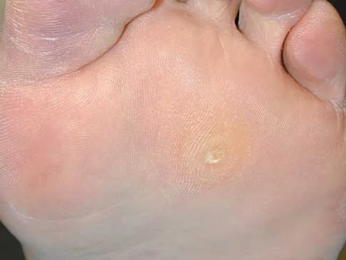 Foot & Ankle 2000 Practice Questions: Set 1 (Solved) - Figure 12