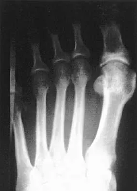 Foot & Ankle 2000 Practice Questions: Set 1 (Solved) - Figure 18