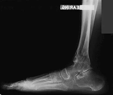 Foot & Ankle 2000 Practice Questions: Set 1 (Solved) - Figure 20