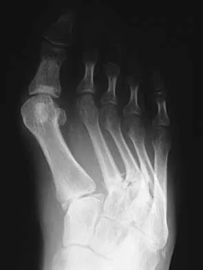 Foot & Ankle 2000 Practice Questions: Set 1 (Solved) - Figure 26