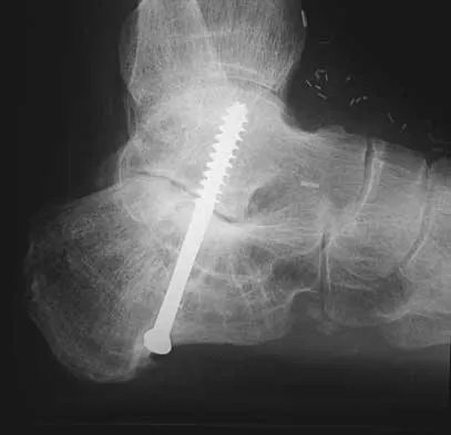 Foot & Ankle 2000 Practice Questions: Set 1 (Solved) - Figure 32