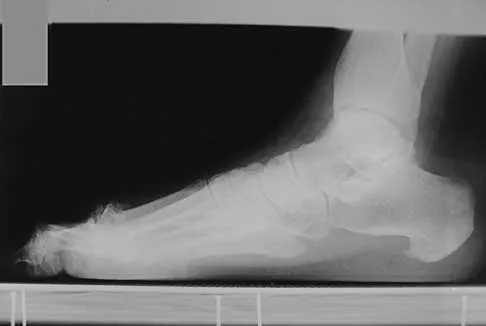 Foot & Ankle 2000 Practice Questions: Set 1 (Solved) - Figure 4