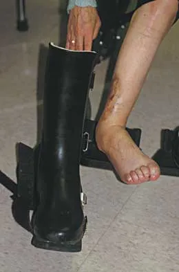 Foot & Ankle Board Review 2000: High-Yield MCQs (Set 2) - Figure 19