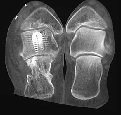 Foot & Ankle Board Review 2000: High-Yield MCQs (Set 2) - Figure 24