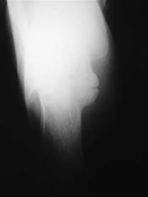 Foot & Ankle Board Review 2000: High-Yield MCQs (Set 2) - Figure 25