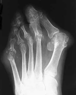 Foot & Ankle Board Review 2000: High-Yield MCQs (Set 2) - Figure 28