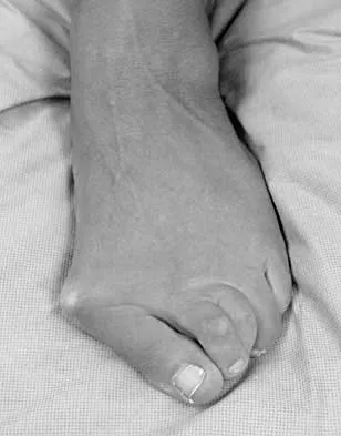 Foot & Ankle Board Review 2000: High-Yield MCQs (Set 2) - Figure 29