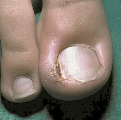 Foot & Ankle Board Review 2000: High-Yield MCQs (Set 2) - Figure 6