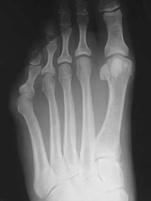 Foot & Ankle 2000 Practice Questions: Set 3 (Solved) - Figure 14