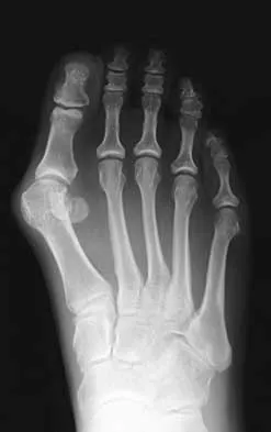 Foot & Ankle 2000 Practice Questions: Set 3 (Solved) - Figure 17