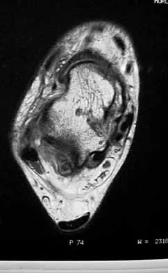 Foot & Ankle Board Review 2000: High-Yield MCQs (Set 4) - Figure 11