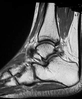 Foot & Ankle Board Review 2000: High-Yield MCQs (Set 4) - Figure 12