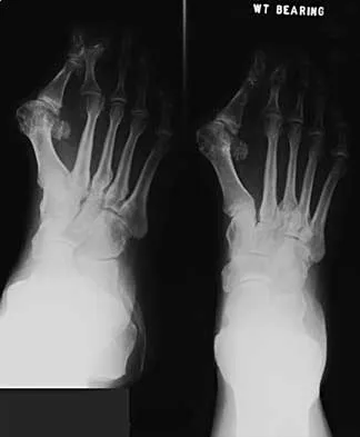 Foot & Ankle Board Review 2000: High-Yield MCQs (Set 4) - Figure 14