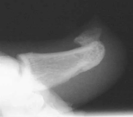 Foot & Ankle Board Review 2000: High-Yield MCQs (Set 4) - Figure 21