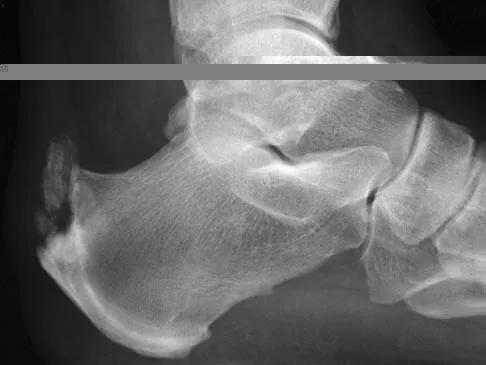 Foot & Ankle 2006 Practice Questions: Set 3 (Solved) Figure 1