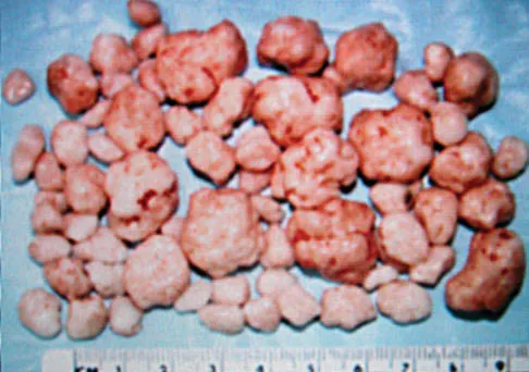 Foot & Ankle 2006 Practice Questions: Set 1 (Solved) - Figure 17