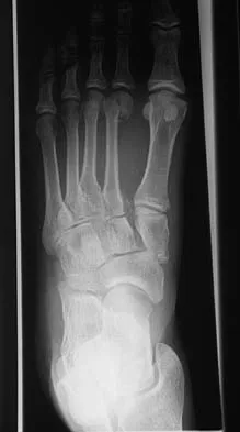 Click to enlarge Foot & Ankle 2006 Practice Questions: Set 1 (Solved) - Figure 19